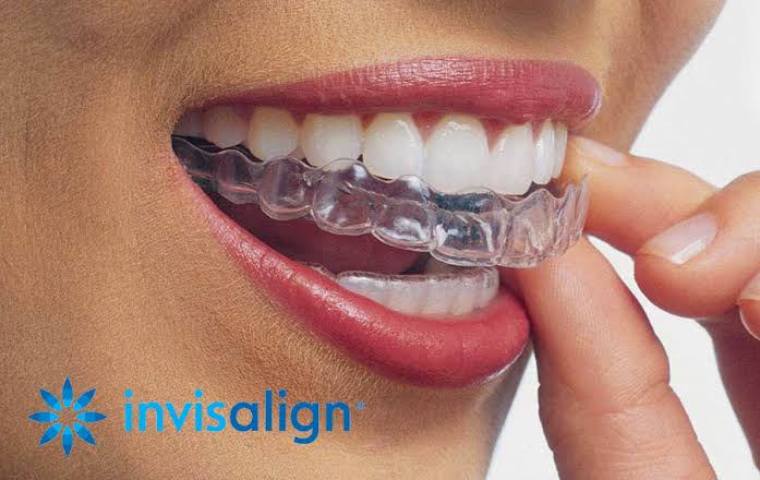 Invisalign Doctor