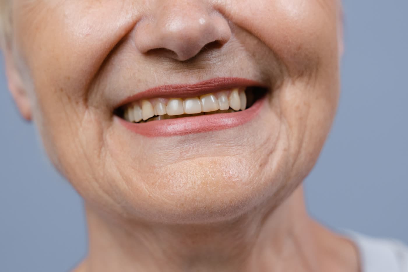 Sorriso natural em destaque