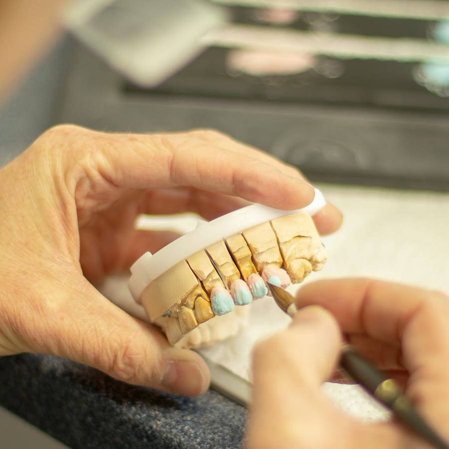 Seleção de cor dental durante avaliação estética